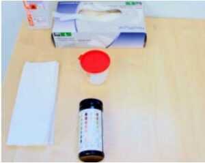 Slika 1. Materijal za pregled urina