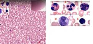 Slika 12. Bojeni razmaz periferne krvi psa. Na razmazu se mogu videti svi krvni elementi eritrociti (crvene krvne ćelije-one su u i najbrojnije), bele krvne ćelije kao i trombociti. A.Eozinofilni granulocit B.Neutrofilni granulocit C.Bazofilni granulocit D.Monocit E.Limfocit F. Eritrociti