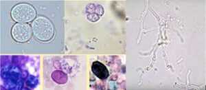 Slika 10. A. Prototheca (alga) i bacili bakterija B. Hife gljiva C. Kandida