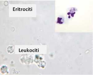 Slika 6. Eritrociti, Leukociti