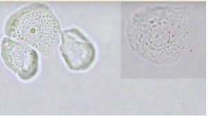 Slika 8. Epitelne ćelija